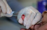 rondonia-avanca-no-controle-da-malaria-com-tratamento-eficaz-em-dose-unica,-fortalecendo-controle-da-transmissao-no-estado